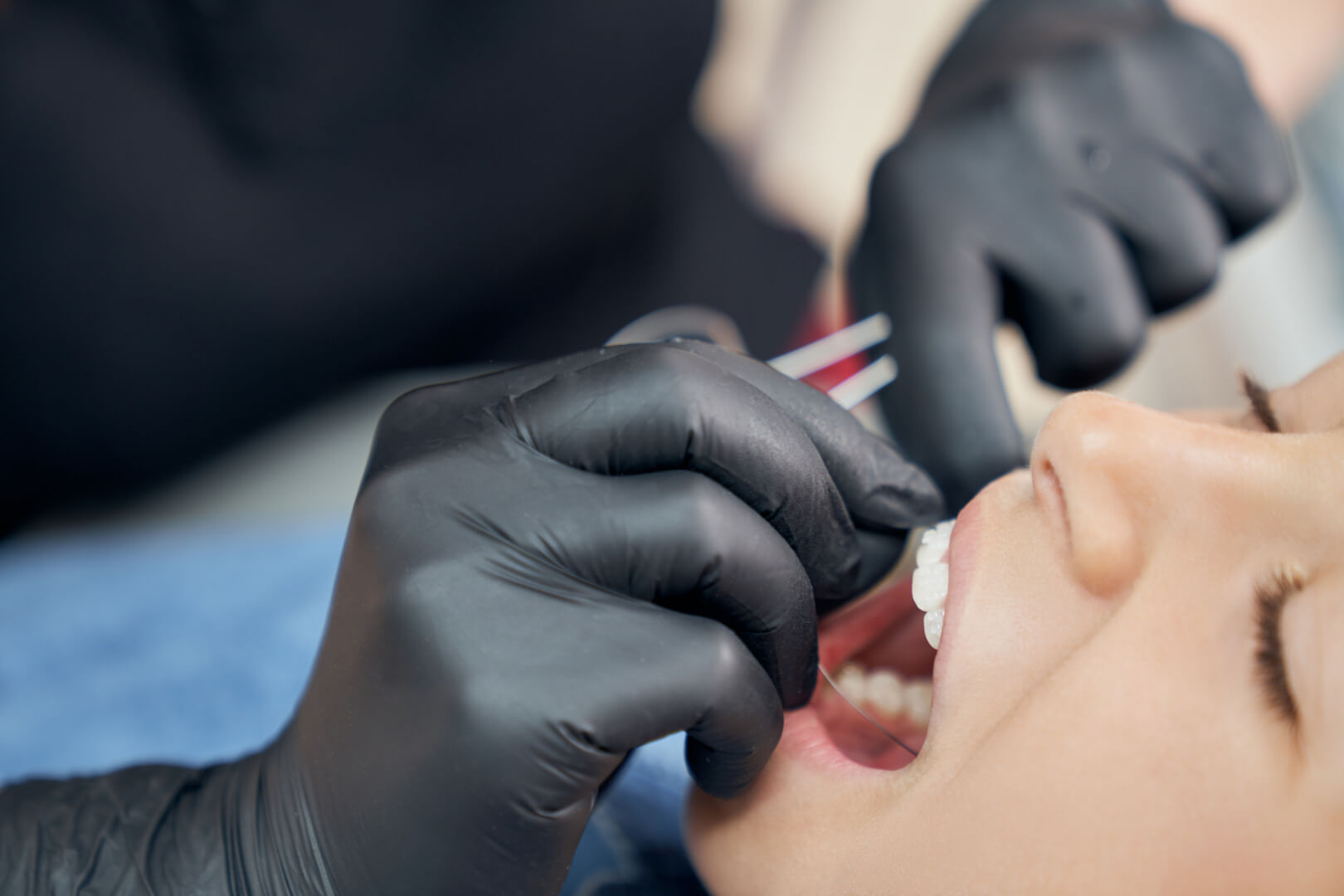 Ghizlane | Blog | Dijital Eklem Splinti Nedir ?